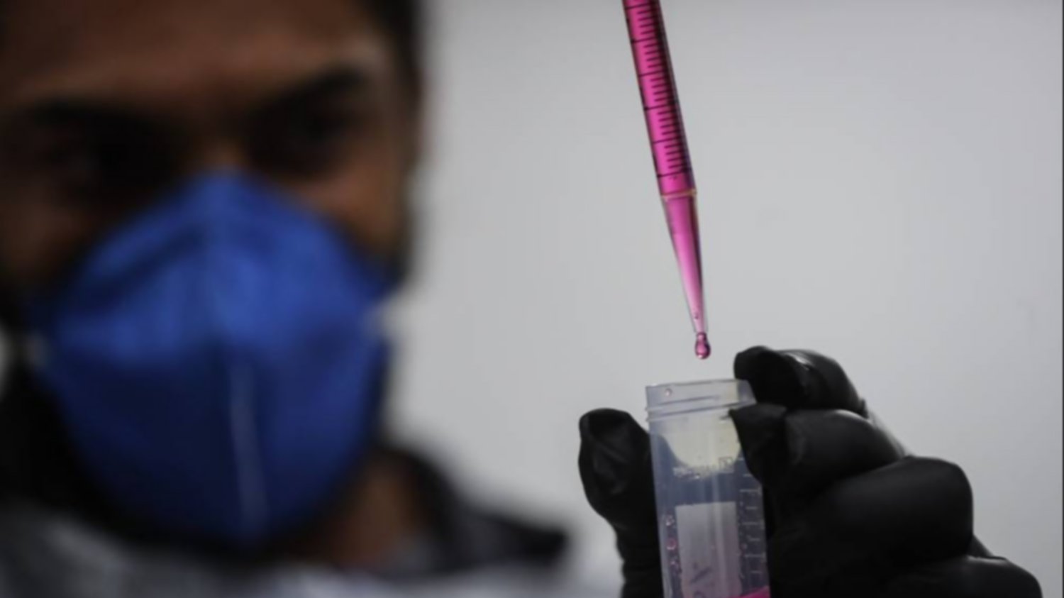 Brasil monitorea 28 casos sospechosos de hepatitis infantil aguda