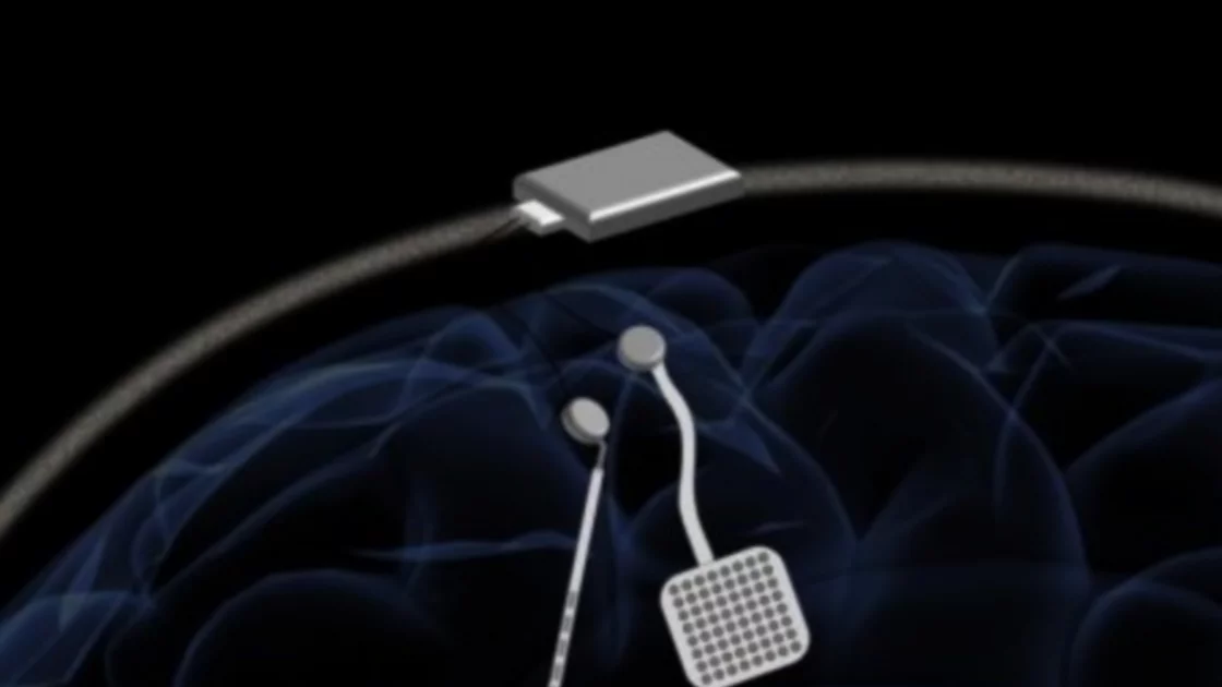 Un marcapasos para tratar el Parkinson y la epilepsia